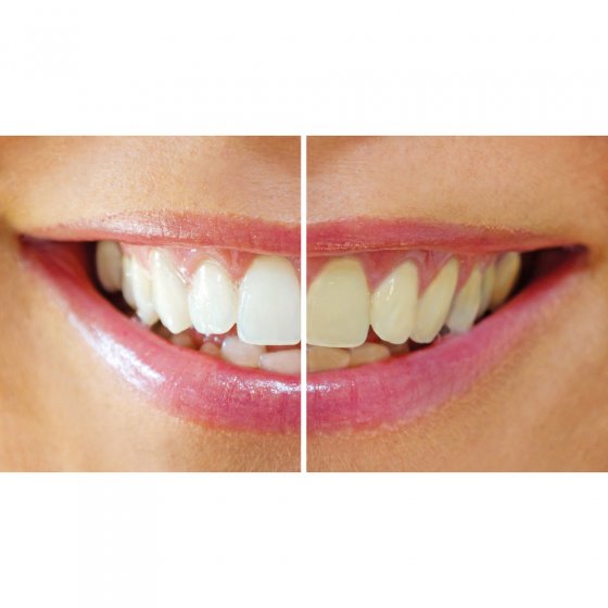 Kit dents blanches, 7 elements 