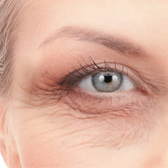 Contour des yeux