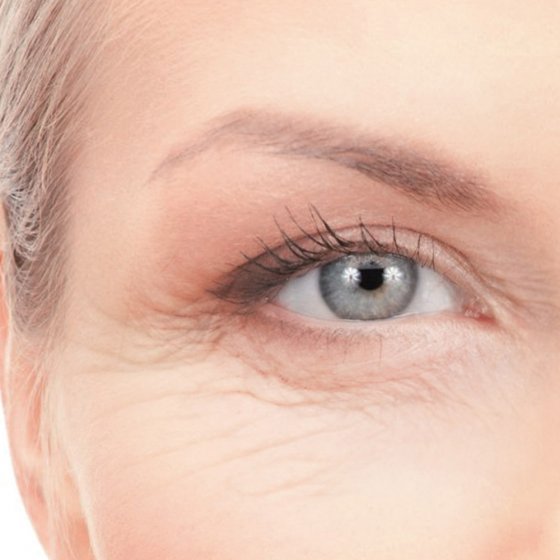 Contour des yeux