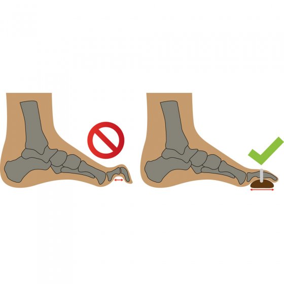 Coussinets pour orteils en marteau Paire 
