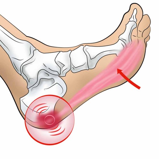 Rouleau de massage pour les pieds 