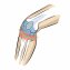 Genouillère pour le tendon rotulien - 5