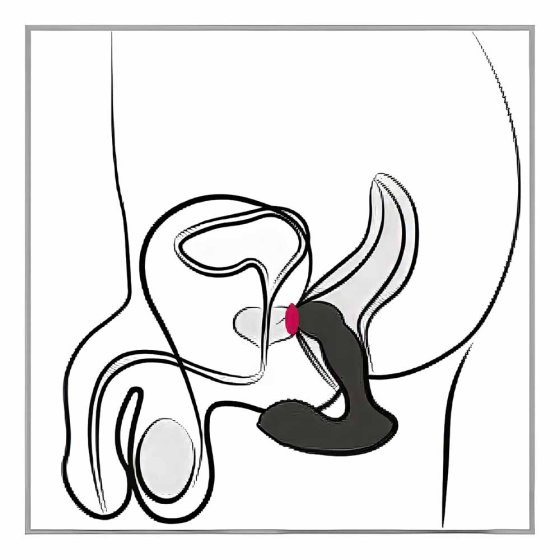 Vibromasseur pour la prostate 